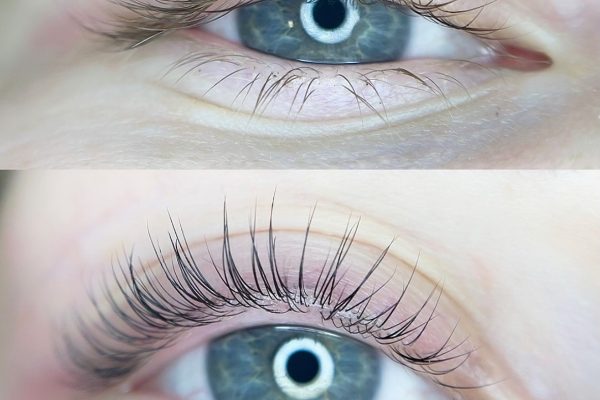 Lash_lifting_pred_a_po3
